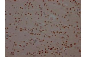 IHC image of ABIN7127371 diluted at 1:100 and staining in paraffin-embedded human brain tissue performed on a Leica BondTM system. (Recombinant BRD4 抗体)