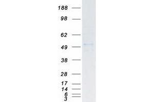 SKP2 Protein (Transcript Variant 1) (Myc-DYKDDDDK Tag)