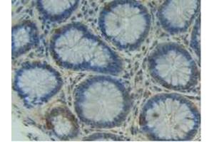 Figure. (ITGAD 抗体  (AA 879-1099))