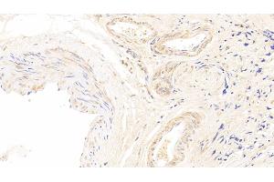 Immunohistochemistry (IHC) image for anti-Cyclin-Dependent Kinase 4 (CDK4) (AA 6-295) antibody (ABIN7433294)