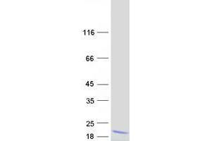 Western Blotting (WB) image for CTD Nuclear Envelope Phosphatase 1 Regulatory Subunit 1 (CNEP1R1) protein (Myc-DYKDDDDK Tag) (ABIN2733883)