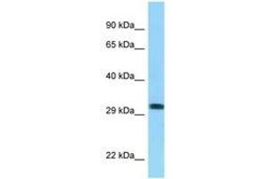Image no. 1 for anti-Rh Blood Group, D Antigen (RHD) (AA 165-214) antibody (ABIN6748103)