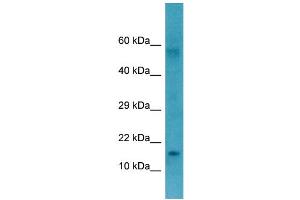 WB Suggested Anti-CTAG1B Antibody Titration: 1. (CTAG1B 抗体  (Middle Region))