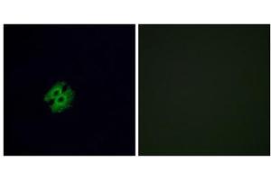 Immunofluorescence analysis of A549 cells, using OR2G2 antibody. (OR2G2 抗体  (C-Term))