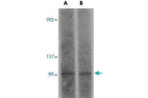 Western blot analysis of FRMPD2 in rat kidney tissue lysate with FRMPD2 polyclonal antibody  at (A) 1 and (B) 2 ug/mL . (FRMPD2 抗体  (N-Term))