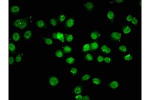 Immunofluorescence staining of Hela cells (treated with 30mM sodium butyrate for 4h) with ABIN7139194 at 1:7. (HIST1H1C 抗体  (acLys74))