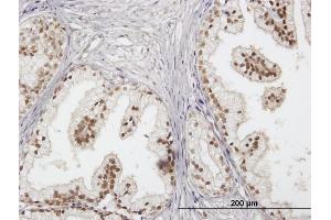 Immunostaining (ISt) image for anti-RAD23 Homolog B (RAD23B) (AA 1-409) antibody (ABIN519601)