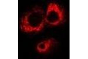 Immunofluorescent analysis of ABO staining in MCF7 cells. (ABO 抗体)