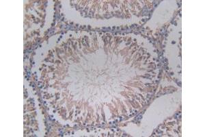DAB staining on IHC-P; Samples: Rat Testis Tissue. (SERPINA6 抗体  (AA 173-344))