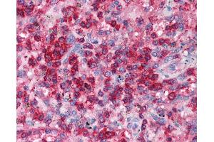 Human Heart; EAP30 antibody - N-terminal region in Human Heart cells using Immunohistochemistry (SNF8 抗体  (N-Term))