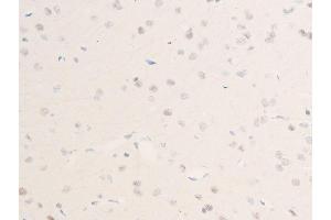 ABIN6256255 and ABIN6267223 at 1/100 staining rat brain tissue sections by IHC-P. (CHEK1 抗体  (pSer301))