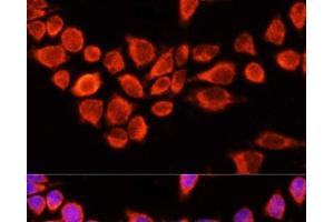 Immunofluorescence analysis of 293T cells using AADAC Polyclonal Antibody at dilution of 1:100 (40x lens). (AADAC 抗体)