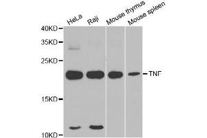 Western blot analysis of extracts of various cell lines, using TNFα antibody. (TNF alpha 抗体  (AA 1-233))