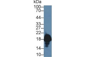 Detection of CPLX1 in Rat Cerebrum lysate using Polyclonal Antibody to Complexin 1 (CPLX1) (Complexin 1 抗体  (AA 1-134))