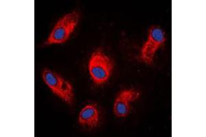 Immunofluorescent analysis of Involucrin staining in MCF7 cells. (Involucrin 抗体  (C-Term))
