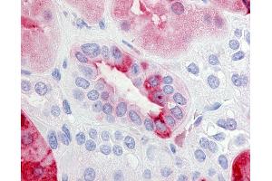 Immunohistochemistry (IHC) image for anti-Prostaglandin E Receptor 2 (Subtype EP2), 53kDa (PTGER2) (C-Term) antibody (ABIN213471)