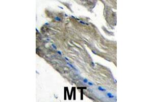 Formalin-fixed and paraffin-embedded human muscle tissue reacted with PIK3CG polyclonal antibody  , which was peroxidase-conjugated to the secondary antibody, followed by DAB staining.