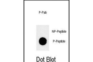 Dot blot analysis of anti-Phospho-JMJD1B-p Phospho-specific Pab (ABIN650878 and ABIN2839821) on nitrocellulose membrane. (KDM3B 抗体  (pSer291))