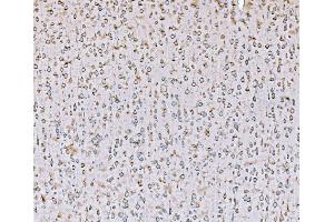 IHC analysis of SND1 using anti-SND1 antibody (ABIN7600525). (SND1 抗体  (AA 20-204))