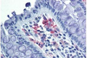 Colon, Human: Formalin-Fixed, Paraffin-Embedded (FFPE) (DC-SIGN/CD209 抗体)