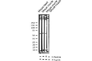 Western Blotting (WB) image for anti-Forkhead Box O4 (FOXO4) (pThr451) antibody (ABIN6256565)