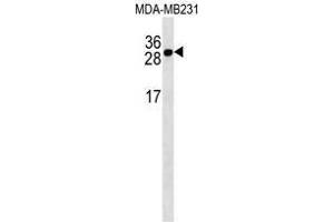 TNFRSF17 Antibody (Center) western blot analysis in MDA-MB231 cell line lysates (35 µg/lane). (BCMA 抗体  (Middle Region))