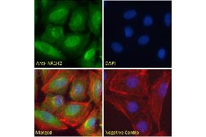 ABIN185293 Immunofluorescence analysis of paraformaldehyde fixed U2OS cells, permeabilized with 0. (NR1H2 抗体  (N-Term))