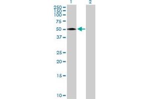 Western Blot analysis of RCN2 expression in transfected 293T cell line by RCN2 MaxPab polyclonal antibody. (RCN2 抗体  (AA 1-317))