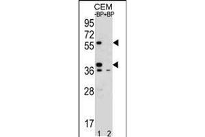 Western blot analysis of MNDA Antibody Pab pre-incubated without(lane 1) and with(lane 2) blocking peptide in CEM cell line lysate (MNDA 抗体  (N-Term))