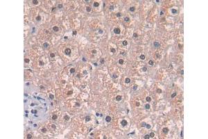 Used in DAB staining on fromalin fixed paraffin- embedded liver tissue (Acetyl-CoA Carboxylase beta 抗体  (AA 29-249))