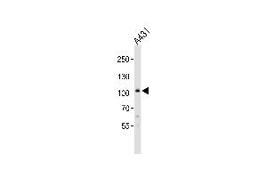 Western Blotting (WB) image for anti-Collagen, Type VI, alpha 1 (COL6A1) (AA 831-858), (C-Term) antibody (ABIN390513)