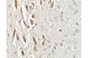 Immunohistochemical analysis of TSHZ3 in mouse brain tissue with TSHZ3 polyclonal antibody  at 2.