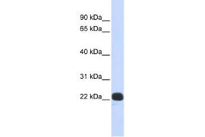 WB Suggested Anti-RCVRN Antibody Titration:  0. (Recoverin 抗体  (N-Term))