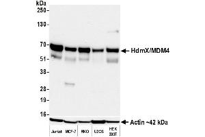 Western Blotting (WB) image for anti-Mdm4-binding Protein (MDM4) (AA 125-175) antibody (ABIN7795618) (Recombinant MDM4-binding Protein 抗体  (AA 125-175))