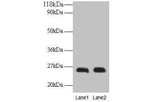 Western blot All lanes: CSH1 antibody at 2 μg/mL Lane 1: A549 whole cell lysate Lane 2: U251 whole cell lysate Secondary Goat polyclonal to rabbit IgG at 1/15000 dilution Predicted band size: 26 kDa Observed band size: 26 kDa (CSH1 抗体  (AA 27-217))