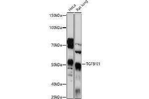Western blot analysis of extracts of various cell lines, using TGFB1I1 antibody (ABIN6129144, ABIN6149074, ABIN6149075 and ABIN6224526) at 1:1000 dilution. (TGFB1I1 抗体  (AA 1-150))