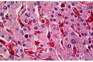 Human Liver: Formalin-Fixed, Paraffin-Embedded (FFPE) (Caveolin-1 抗体  (C-Term))