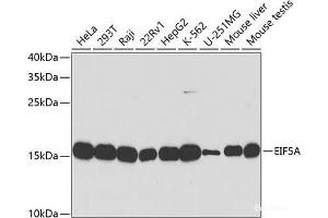 Western blot analysis of extracts of various cell lines using EIF5A Polyclonal Antibody at dilution of 1:1000. (EIF5A 抗体)