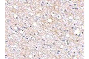 Immunohistochemical staining of human brain tissue using PLXDC2 polyclonal antibody  at 2.