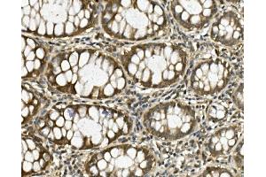 IHC analysis of HGS using anti-HGS antibody (ABIN7601205).