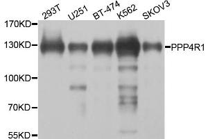Western blot analysis of extracts of various cell lines, using PPP4R1 antibody. (PPP4R1 抗体)