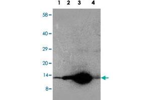 Western blot analysis of tissue extracts with DDT polyclonal antibody . (DDT 抗体  (C-Term))