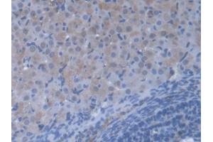 DAB staining on IHC-P; Samples: Mouse Ovary Tissue (VARS 抗体  (AA 186-421))
