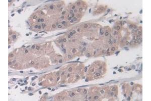 Immunohistochemistry (IHC) image for anti-Proteasome (Prosome, Macropain) Subunit, beta Type, 8 (Large Multifunctional Peptidase 7) (PSMB8) (AA 75-261) antibody (ABIN7440236)