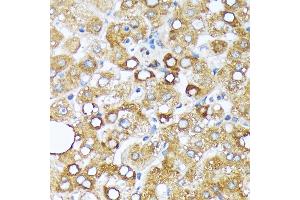 Immunohistochemistry (IHC) image for anti-Cytochrome P450, Family 4, Subfamily A, Polypeptide 11 (CYP4A11) antibody (ABIN7266658)