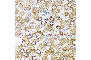 Immunohistochemistry of paraffin-embedded human liver using Cytochrome P450 4A (CYP4) (CYP4) Rabbit mAb (ABIN7266658) at dilution of 1:100 (40x lens). (CYP4A11 抗体)