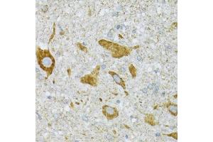 Immunohistochemistry of paraffin-embedded mouse spinal cord using ST3GAL3 antibody (ABIN2560155) at dilution of 1:100 (40x lens). (ST3GAL3 抗体)