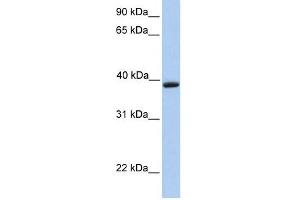Aquaporin 10 antibody used at 1 ug/ml to detect target protein. (Aquaporin 10 抗体  (C-Term))