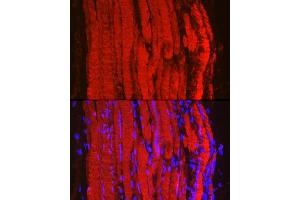 Immunofluorescence analysis of mouse skeletal muscle using Fbx32/FBOX32 Rabbit pAb (ABIN6134167, ABIN6140522 and ABIN7101804) at dilution of 1:100 (40x lens). (FBXO32 抗体)