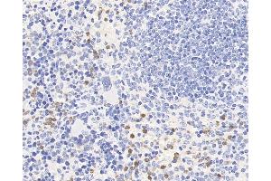 Immunohistochemistry analysis of paraffin-embedded mouse spleen using CCR5 Polyclonal Antibody at dilution of 1:300. (CCR5 抗体)